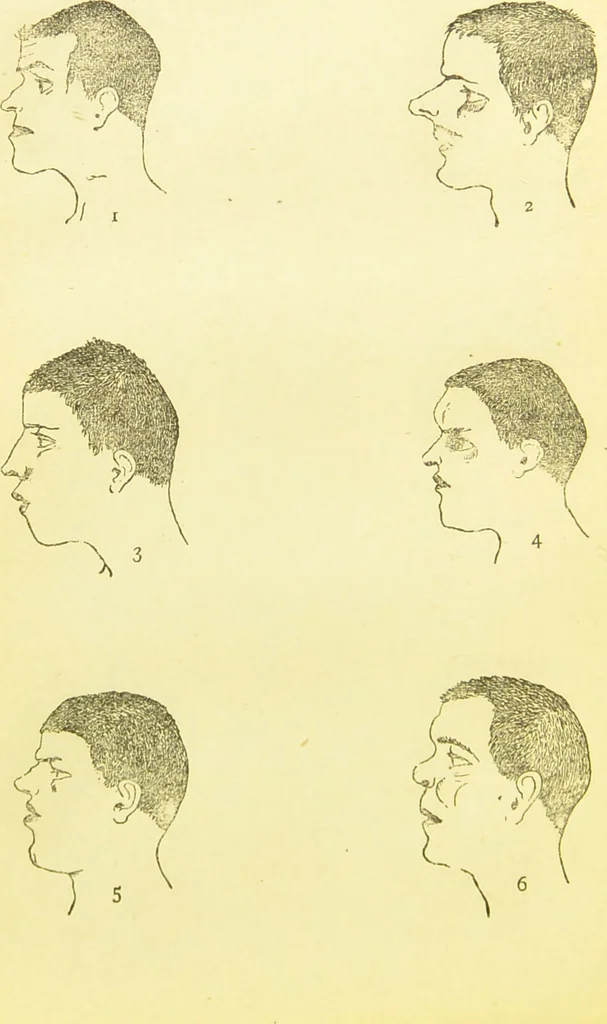 An illustration from The criminal / by Havelock Ellis., 1890, leaf 70