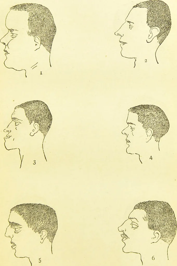 An illustration from The criminal / by Havelock Ellis., 1890, leaf 71