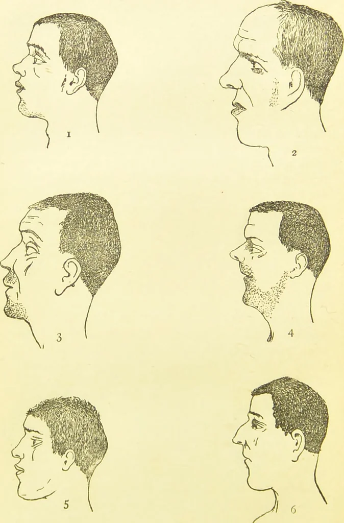An illustration from The criminal / by Havelock Ellis., 1890, leaf 72