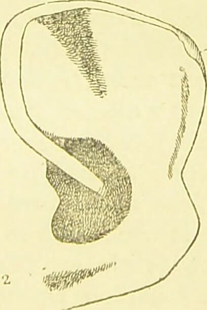 An illustration from The criminal / by Havelock Ellis., 1890, leaf 77