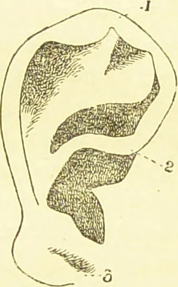 An illustration from The criminal / by Havelock Ellis., 1890, leaf 79