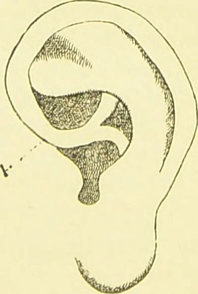 An illustration from The criminal / by Havelock Ellis., 1890, leaf 81