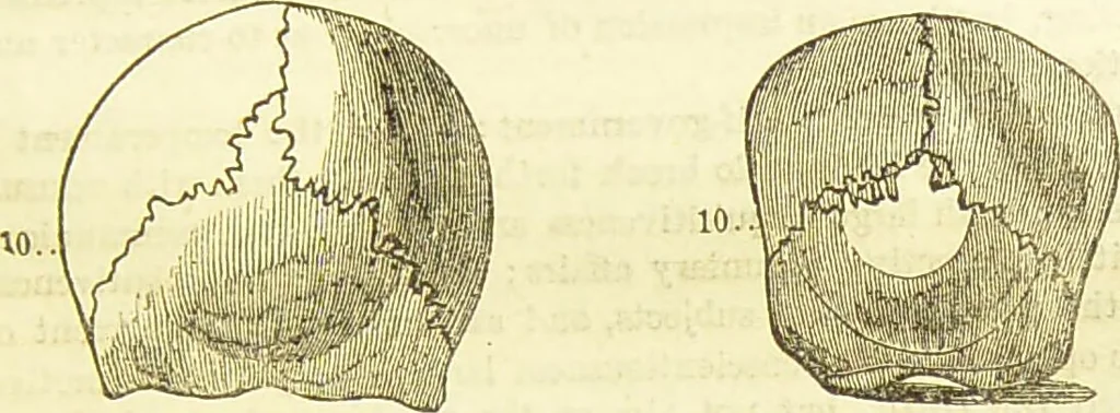 An illustration from New illustrated self-instructor in phrenology and physiology : together with the chart and character of ... as marked by ... / by O.S. and L.N. Fowler., 1877, leaf 107