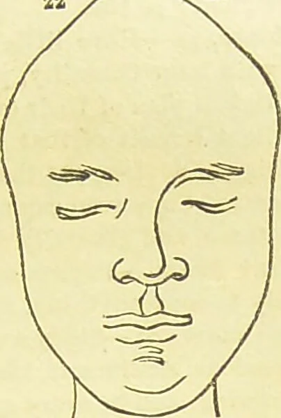 An illustration from New illustrated self-instructor in phrenology and physiology : together with the chart and character of ... as marked by ... / by O.S. and L.N. Fowler., 1877, leaf 139