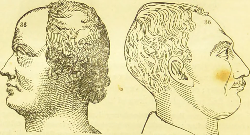 An illustration from New illustrated self-instructor in phrenology and physiology : together with the chart and character of ... as marked by ... / by O.S. and L.N. Fowler., 1877, leaf 164
