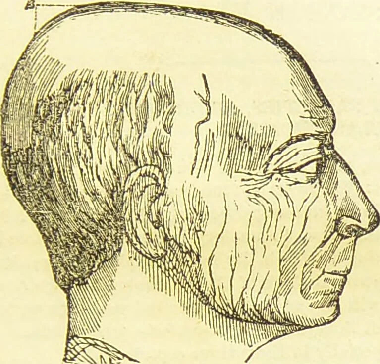 An illustration from New illustrated self-instructor in phrenology and physiology : together with the chart and character of ... as marked by ... / by O.S. and L.N. Fowler., 1877, leaf 73