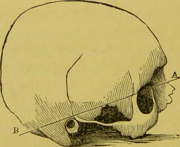 An illustration from The natural history of the human temperaments : their laws in relation to marriage, and the fatal consequences of their violation to progeny, with the indications of vigorous life and longevity : followed by a fugitive essay on the protection of society against crime / by W. Byrd Powell., 1869, leaf 184
