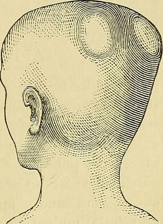 An illustration from How to teach according to temperament and mental development or : Phrenology in the school-room and the family / by Nelson Sizer., 1877, leaf 259