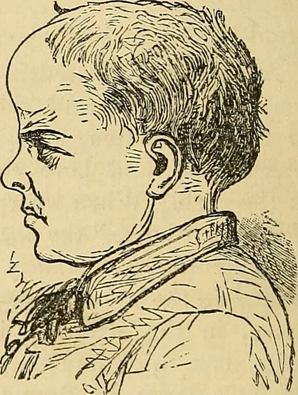 An illustration from How to teach according to temperament and mental development or : Phrenology in the school-room and the family / by Nelson Sizer., 1877, leaf 78