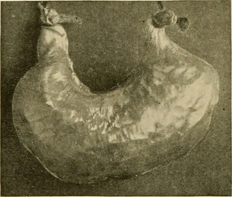 An illustration from Pediatrics : the hygienic and medical treatment of children / by Thomas Morgan Rotch., 1898, leaf 100