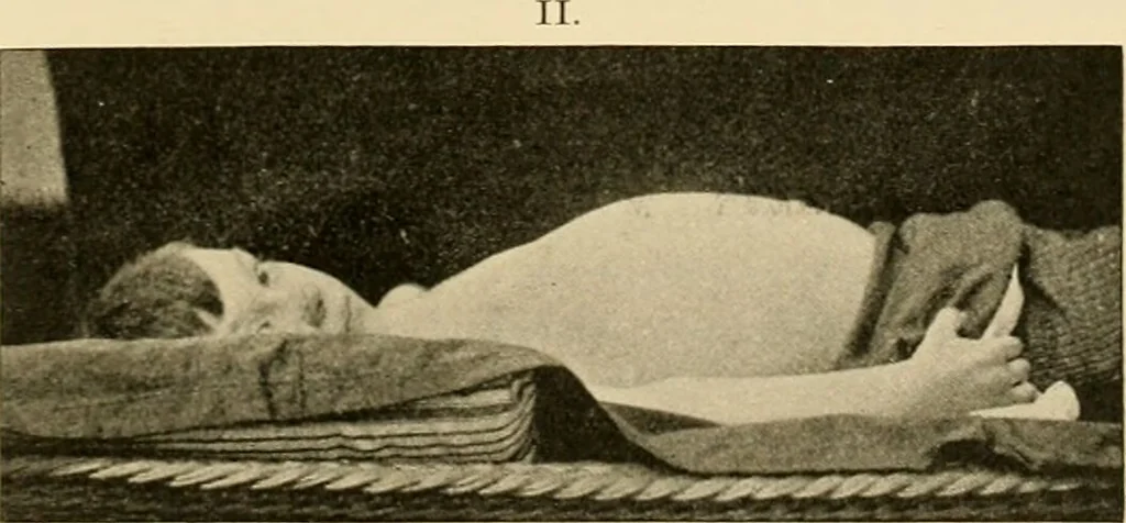 An illustration from Pediatrics : the hygienic and medical treatment of children / by Thomas Morgan Rotch., 1898, leaf 1003