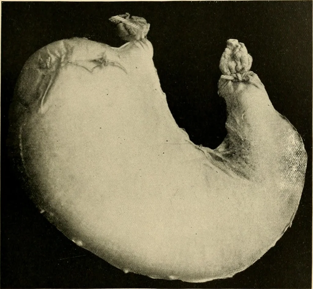 An illustration from Pediatrics : the hygienic and medical treatment of children / by Thomas Morgan Rotch., 1898, leaf 103