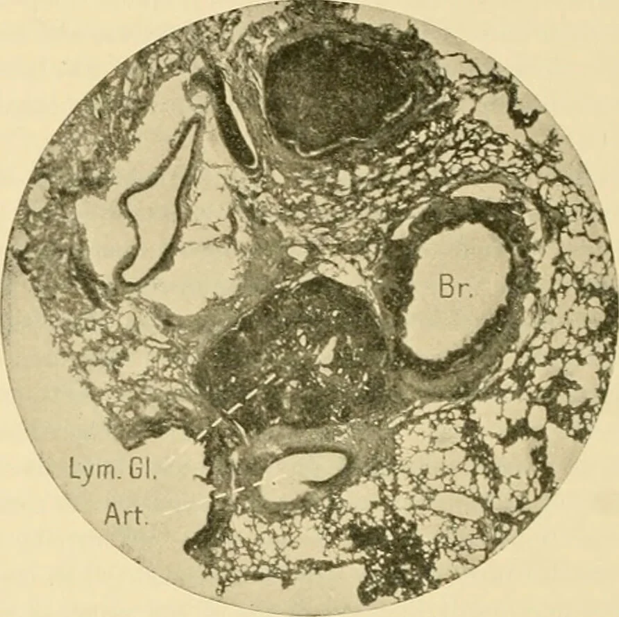 An illustration from Pediatrics : the hygienic and medical treatment of children / by Thomas Morgan Rotch., 1898, leaf 1034