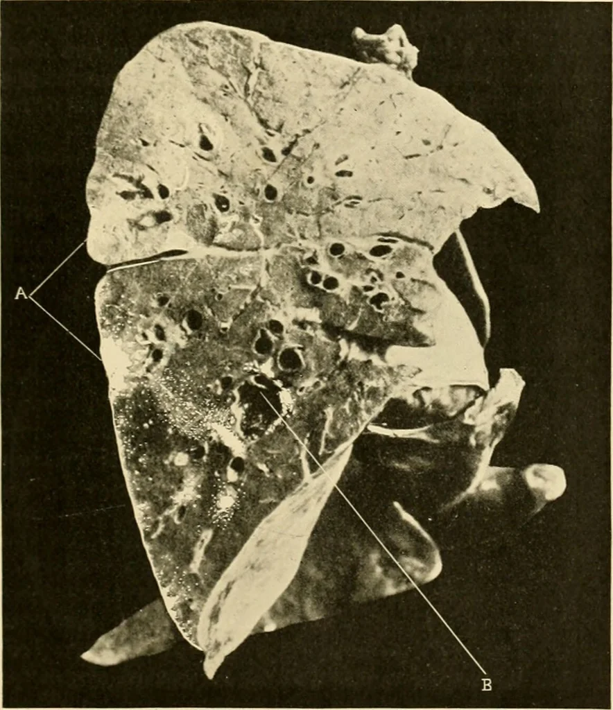 An illustration from Pediatrics : the hygienic and medical treatment of children / by Thomas Morgan Rotch., 1898, leaf 1041