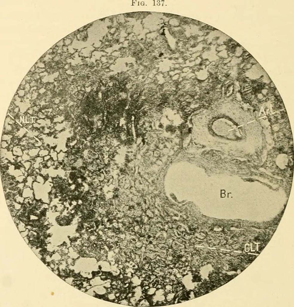 An illustration from Pediatrics : the hygienic and medical treatment of children / by Thomas Morgan Rotch., 1898, leaf 1044