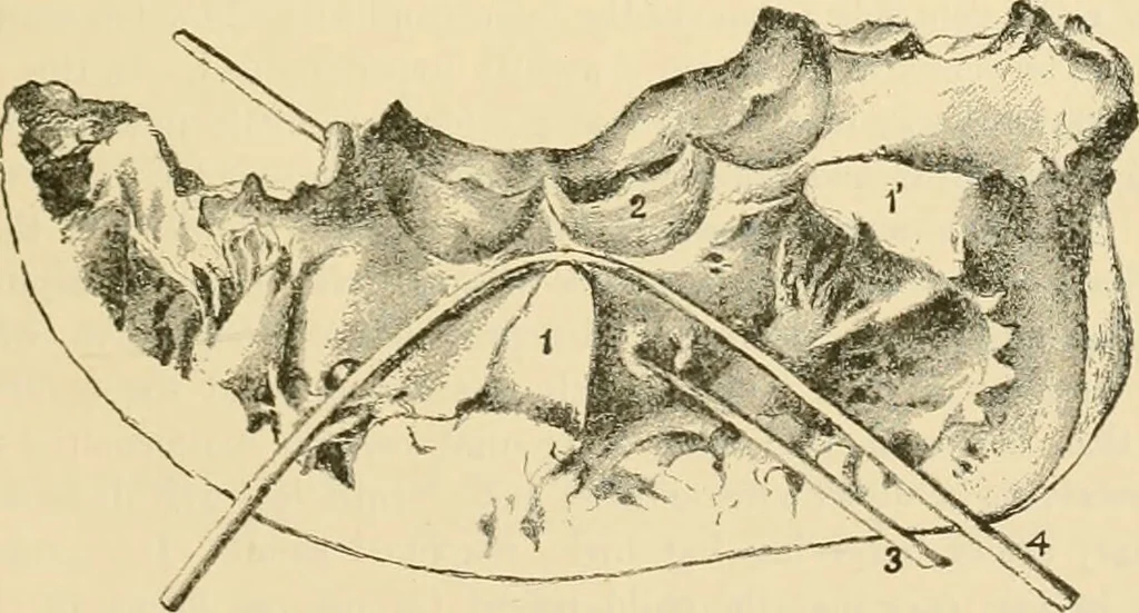 An illustration from Pediatrics : the hygienic and medical treatment of children / by Thomas Morgan Rotch., 1898, leaf 1101