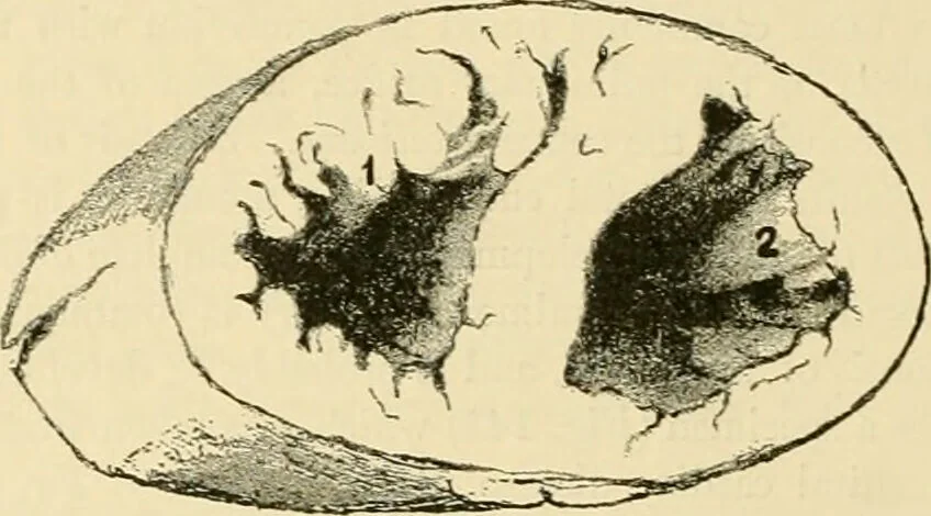 An illustration from Pediatrics : the hygienic and medical treatment of children / by Thomas Morgan Rotch., 1898, leaf 1102