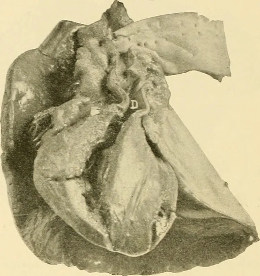 An illustration from Pediatrics : the hygienic and medical treatment of children / by Thomas Morgan Rotch., 1898, leaf 1104