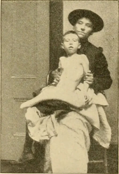 An illustration from Pediatrics : the hygienic and medical treatment of children / by Thomas Morgan Rotch., 1898, leaf 1129