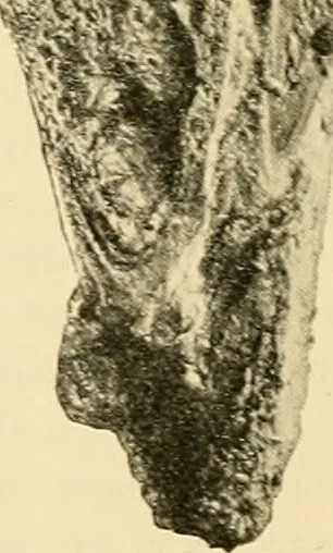 An illustration from Pediatrics : the hygienic and medical treatment of children / by Thomas Morgan Rotch., 1898, leaf 1150