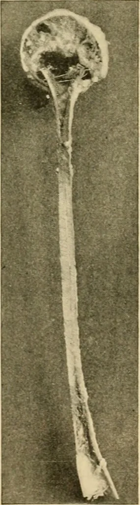An illustration from Pediatrics : the hygienic and medical treatment of children / by Thomas Morgan Rotch., 1898, leaf 1151