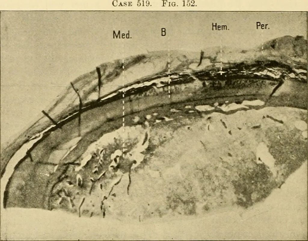 An illustration from Pediatrics : the hygienic and medical treatment of children / by Thomas Morgan Rotch., 1898, leaf 1162