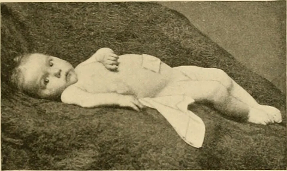 An illustration from Pediatrics : the hygienic and medical treatment of children / by Thomas Morgan Rotch., 1898, leaf 1165