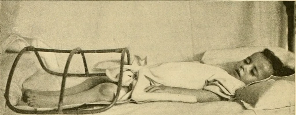 An illustration from Pediatrics : the hygienic and medical treatment of children / by Thomas Morgan Rotch., 1898, leaf 1168