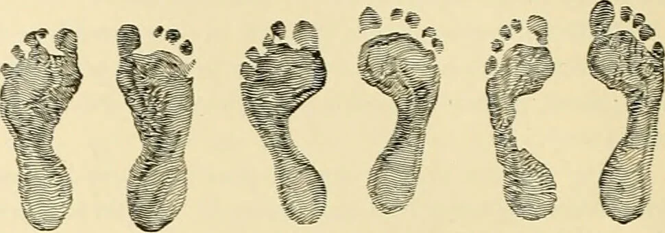 An illustration from Pediatrics : the hygienic and medical treatment of children / by Thomas Morgan Rotch., 1898, leaf 124