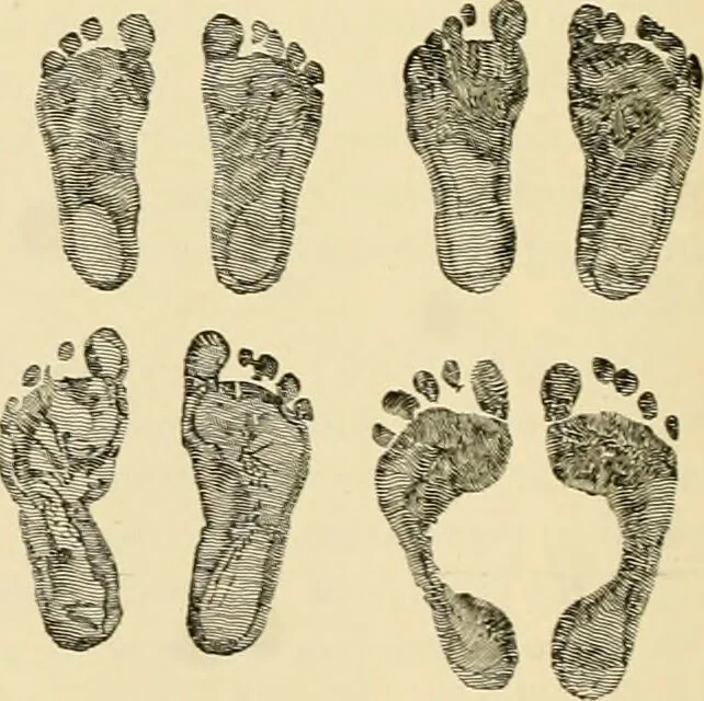 An illustration from Pediatrics : the hygienic and medical treatment of children / by Thomas Morgan Rotch., 1898, leaf 124