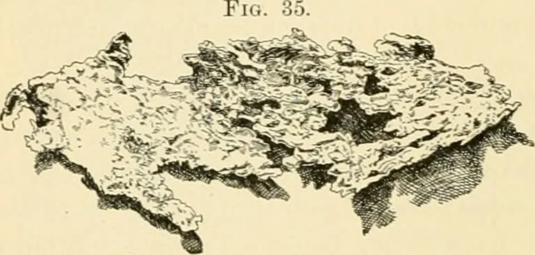 An illustration from Pediatrics : the hygienic and medical treatment of children / by Thomas Morgan Rotch., 1898, leaf 152