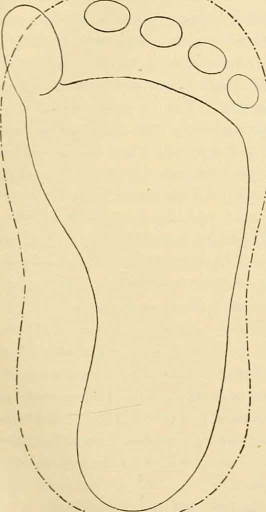 An illustration from Pediatrics : the hygienic and medical treatment of children / by Thomas Morgan Rotch., 1898, leaf 165
