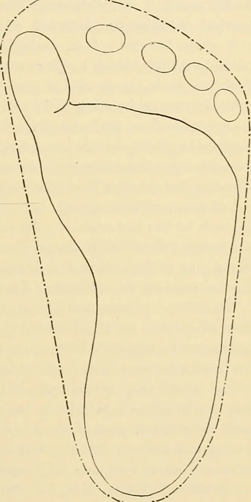 An illustration from Pediatrics : the hygienic and medical treatment of children / by Thomas Morgan Rotch., 1898, leaf 165