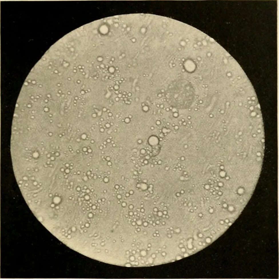An illustration from Pediatrics : the hygienic and medical treatment of children / by Thomas Morgan Rotch., 1898, leaf 195