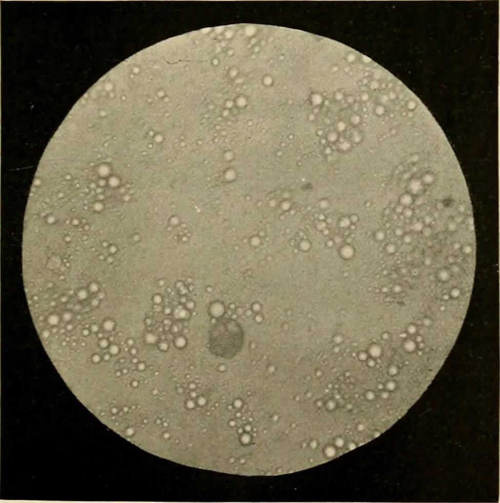 An illustration from Pediatrics : the hygienic and medical treatment of children / by Thomas Morgan Rotch., 1898, leaf 195