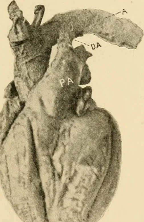 An illustration from Pediatrics : the hygienic and medical treatment of children / by Thomas Morgan Rotch., 1898, leaf 25