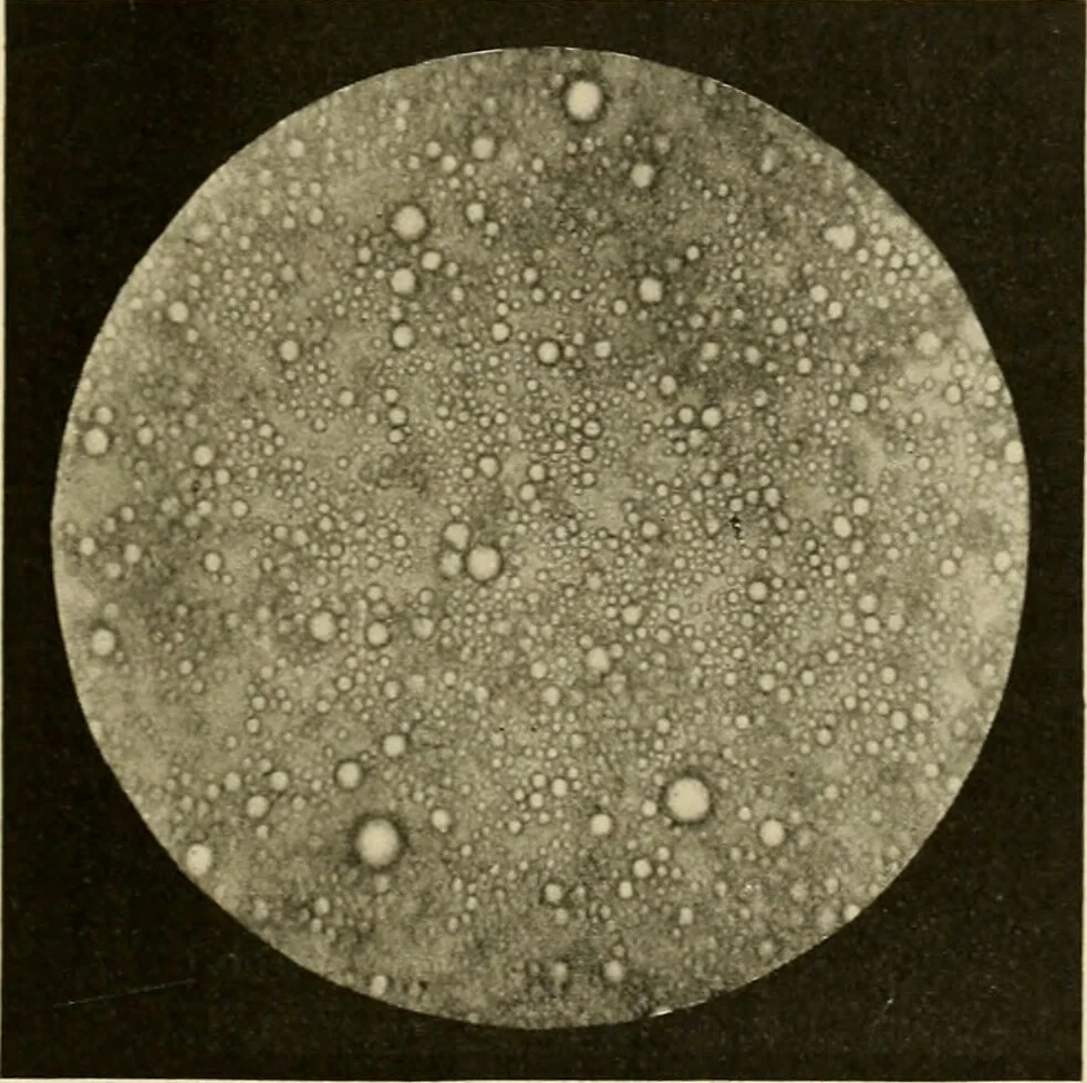 An illustration from Pediatrics : the hygienic and medical treatment of children / by Thomas Morgan Rotch., 1898, leaf 291