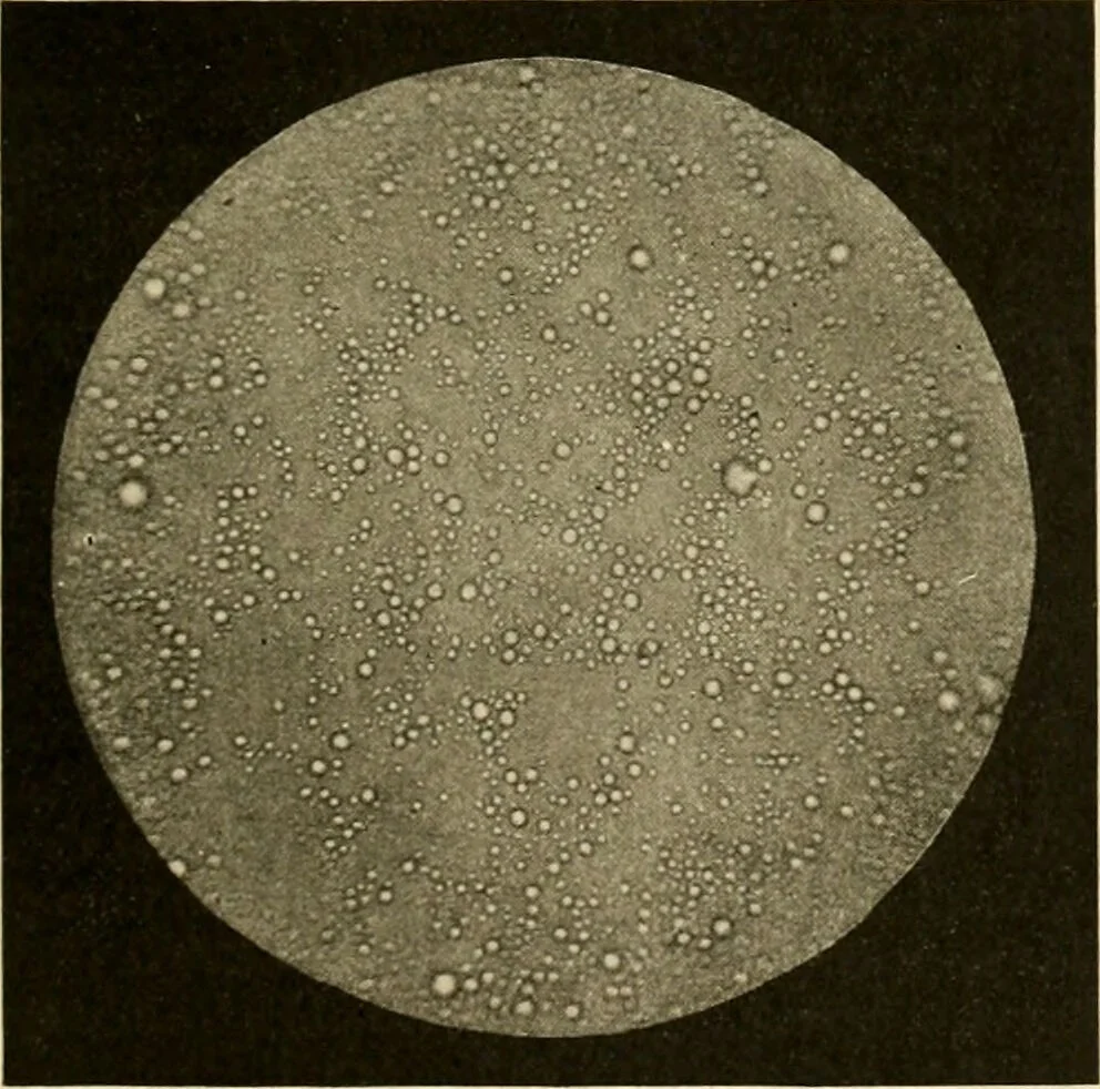 An illustration from Pediatrics : the hygienic and medical treatment of children / by Thomas Morgan Rotch., 1898, leaf 293