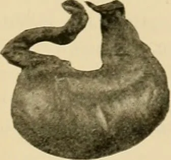 An illustration from Pediatrics : the hygienic and medical treatment of children / by Thomas Morgan Rotch., 1898, leaf 329