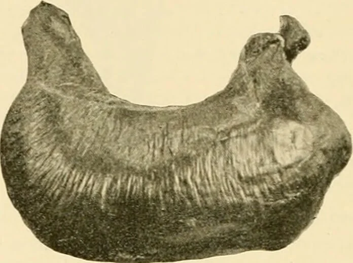 An illustration from Pediatrics : the hygienic and medical treatment of children / by Thomas Morgan Rotch., 1898, leaf 330