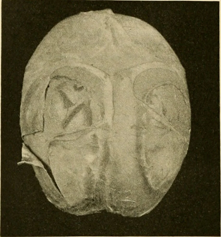 An illustration from Pediatrics : the hygienic and medical treatment of children / by Thomas Morgan Rotch., 1898, leaf 448