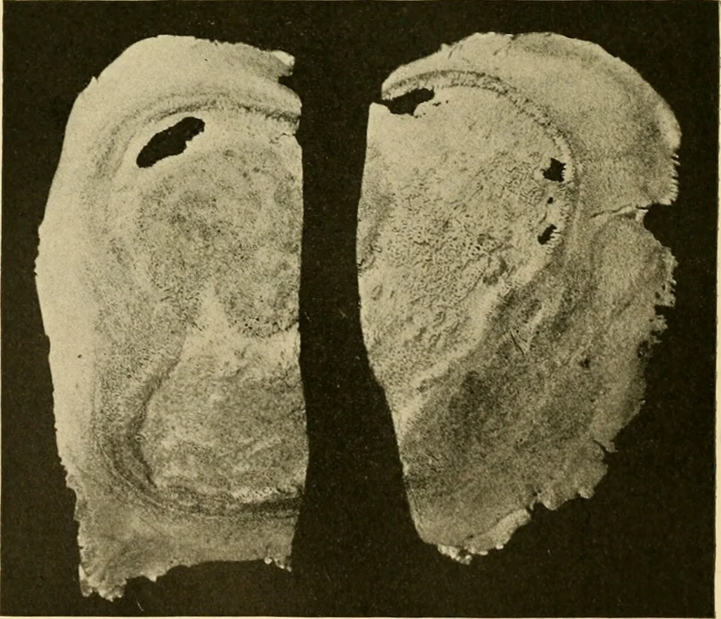 An illustration from Pediatrics : the hygienic and medical treatment of children / by Thomas Morgan Rotch., 1898, leaf 448