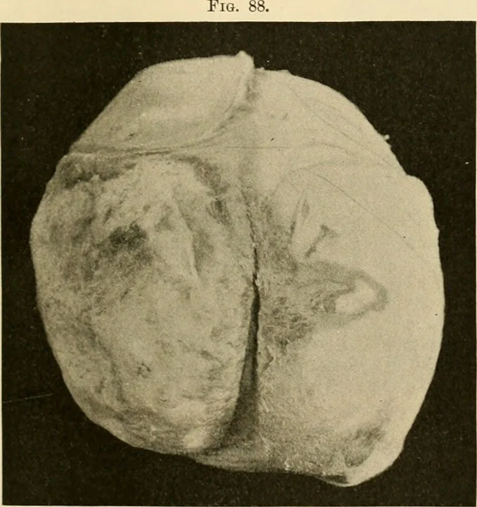 An illustration from Pediatrics : the hygienic and medical treatment of children / by Thomas Morgan Rotch., 1898, leaf 449
