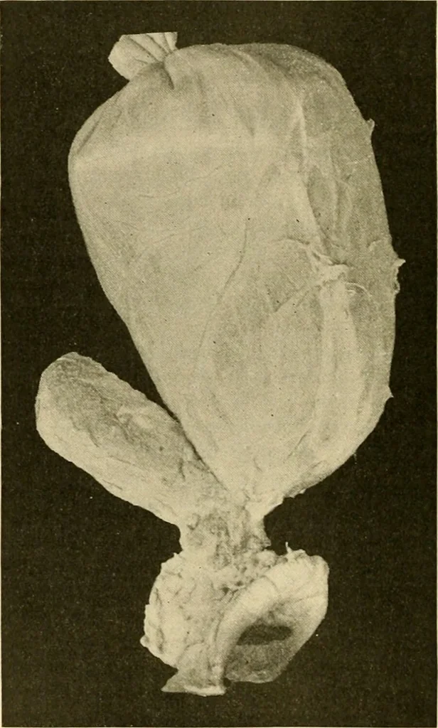 An illustration from Pediatrics : the hygienic and medical treatment of children / by Thomas Morgan Rotch., 1898, leaf 480