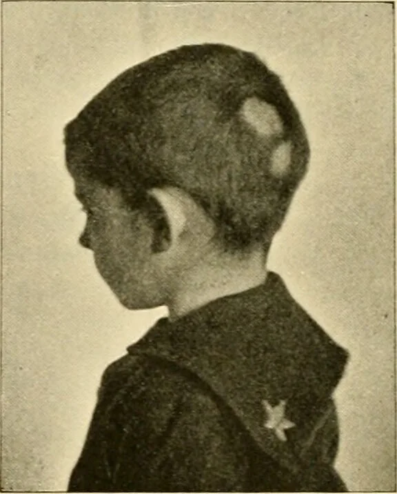 An illustration from Pediatrics : the hygienic and medical treatment of children / by Thomas Morgan Rotch., 1898, leaf 506