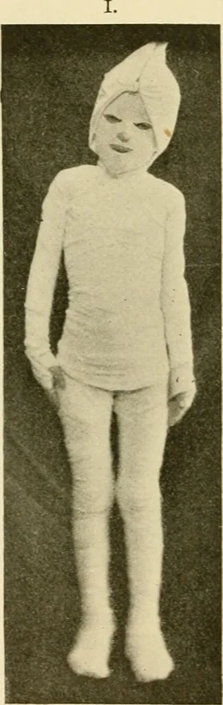 An illustration from Pediatrics : the hygienic and medical treatment of children / by Thomas Morgan Rotch., 1898, leaf 520
