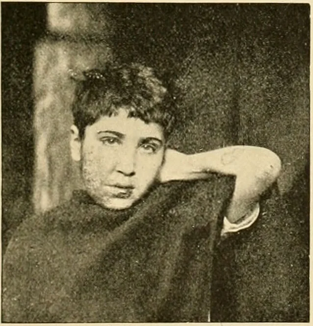 An illustration from Pediatrics : the hygienic and medical treatment of children / by Thomas Morgan Rotch., 1898, leaf 533