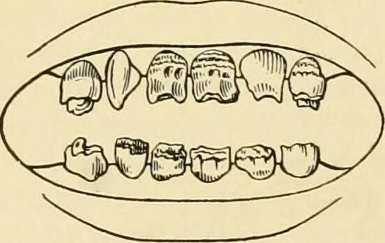 An illustration from Pediatrics : the hygienic and medical treatment of children / by Thomas Morgan Rotch., 1898, leaf 558