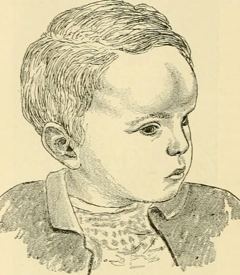 An illustration from Pediatrics : the hygienic and medical treatment of children / by Thomas Morgan Rotch., 1898, leaf 560