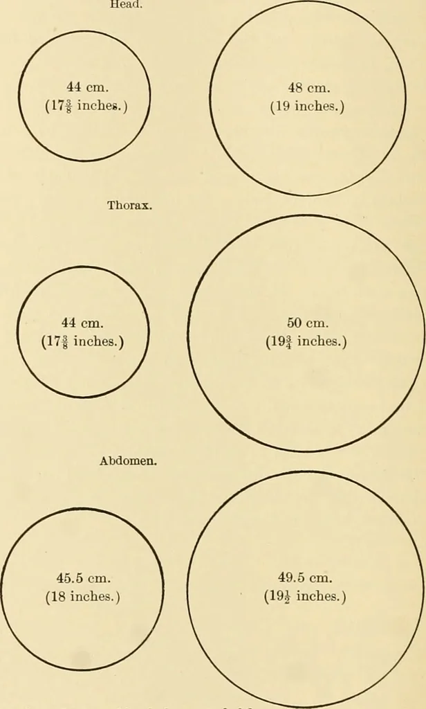 An illustration from Pediatrics : the hygienic and medical treatment of children / by Thomas Morgan Rotch., 1898, leaf 72